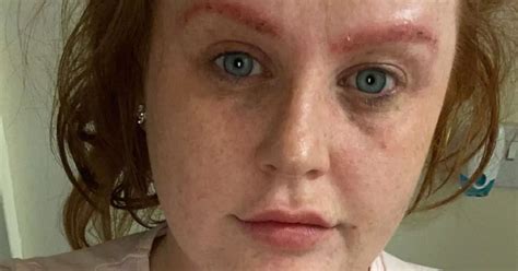 Woman Left Feeling Like A Monster After Eyebrow Tinting Went Wrong Belfast Live