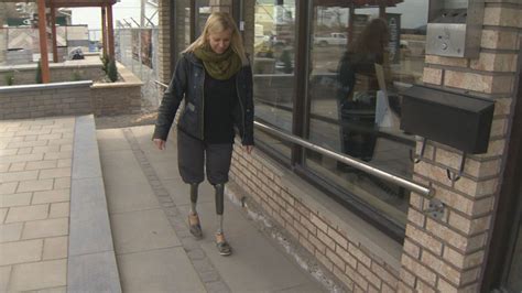 Montreal Woman Gets ‘back On Her Feet After Losing Legs To Flesh