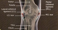 KNEE LIGAMENT INJURY | Klinique Pain Management & Wellbeing Clinic