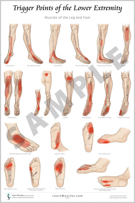 Trigger Point Lower Extremity 24 X 36 Premium Poster 2 Pack Pre
