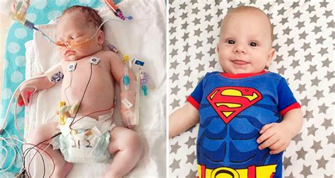 Newborn Baby Born With Congenital Fibrosarcoma Cancer Thats Life