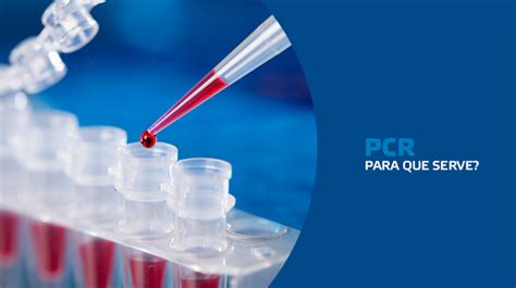 Para Que Serve O Exame PCR