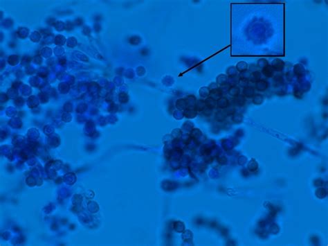 Il genere aspergillus comprende un gruppo eterogeneo di muffe tossigene. Fun With Microbiology (What's Buggin' You?): Aspergillus ...