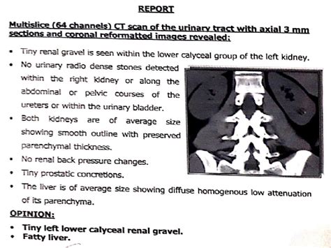 Multisided Ct Scan Of Urinary Tract Download Scientific Diagram