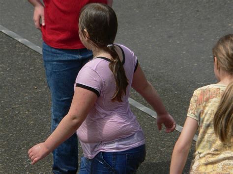 Being Overweight In Kindergarten Sets Stage For Later Obesity