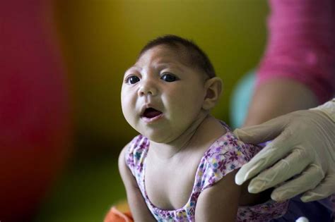 Zika is a virus that a person can catch if bitten by an infected mosquito. Delayed onset: Damage from Zika can appear up to a year ...