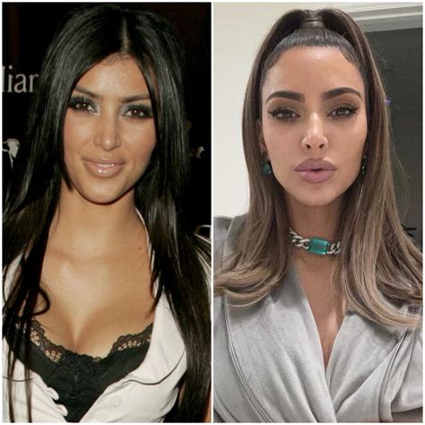Collection 92 Pictures Kim Kardashian Face Before And After Full Hd 2k 4k
