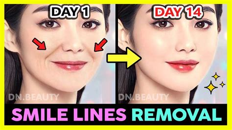 Compelling Smile Lines Laugh Lines Removal And Fill With Korean Face Exercise And Massage In 2