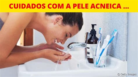 Dicas De Cuidados Para Pele Acneica Como Previnir As Espinhas E Acnes