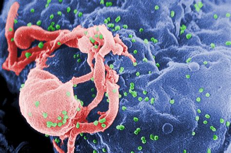 줄기세포로 HIV 감염 환자 치료 성공두 번째 사례 나와 배승주 네이버 블로그