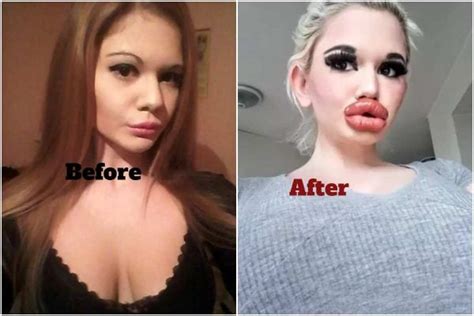Woman Who Wants To Be Real Life Barbie Shows Off Huge Lips Guardian