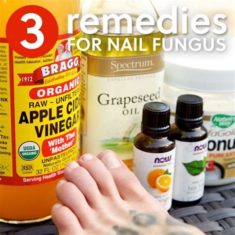 3 Simple Home Remedies For Toenail Fungus Everyday Roots