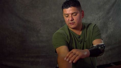 Ramon Padilla And Cutting Edge Prosthetics Video Military Medicine