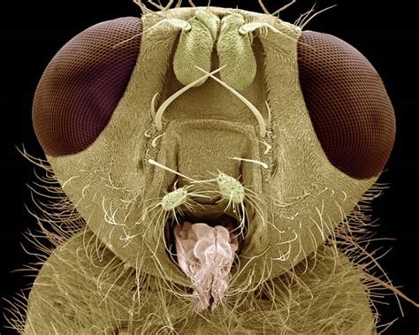 Amazing Scanning Electron Microscope Pictures Of Insects And Spiders