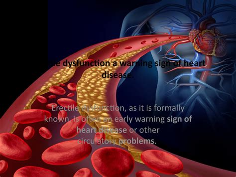 Erectile Dysfunction A Warning Sign Of Heart Disease By Arniawinslow Issuu