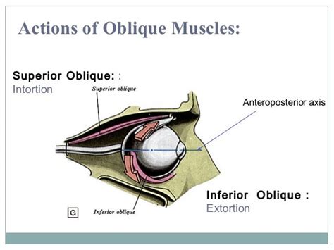 Orbit And Extra Ocular Muscles
