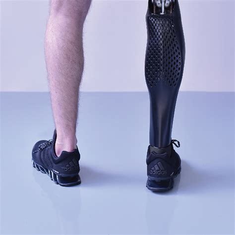 Beautifully Crafted 3d Printed Prosthetic Leg Cover In The Form Of