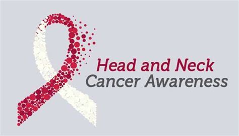 Ministry Raises Awareness About Head And Neck Cancer