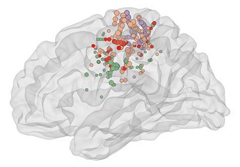 Mayo Clinic Neuroscientists Discover A New Brain Area Mayo Clinic