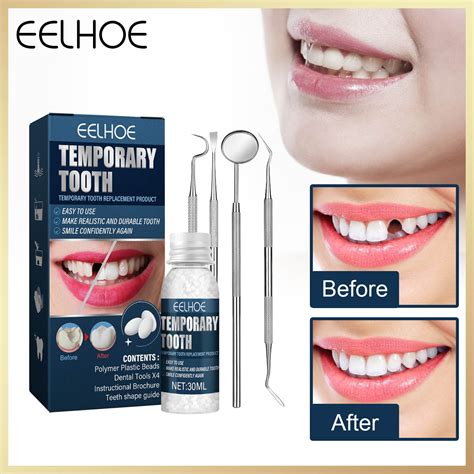 Eelhoe Temporary Tooth Repair Kit Filling And Gaps False Solid Glue