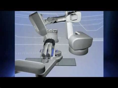 CyberKnife Radiosurgery Prostate Treatment YouTube