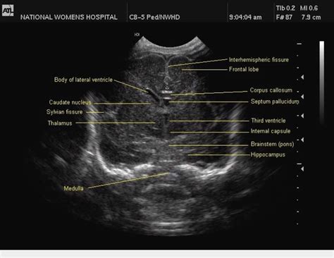 Fetal Ultrasound Diagnostic Medical Sonography Diagnostic Imaging