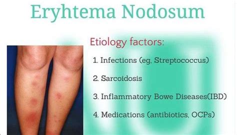 Cause Of Erythema Nodosum Medizzy