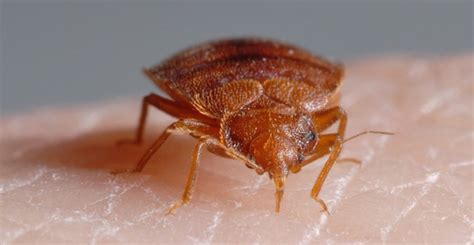 Do I Have Bed Bug Bites 5 Bed Bug Bite Symptoms To Check