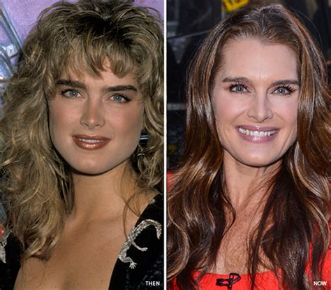 Did Brooke Shields Get Plastic Surgery Including Botox And Nose Job