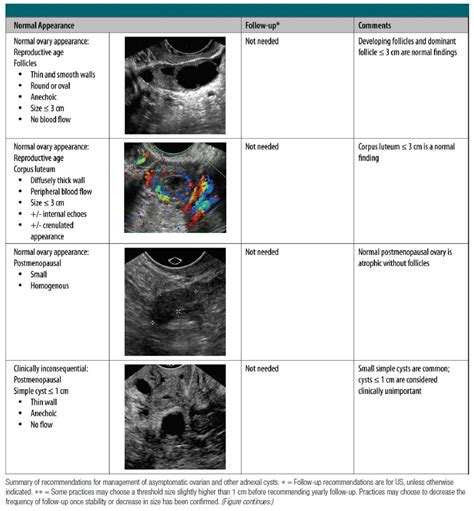 ovarian cyst f u guideline radiology world