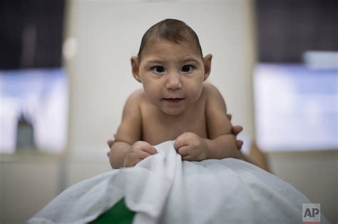 Zika Syndrome Health Problems Mount As Babies Turn 1 — Ap Photos