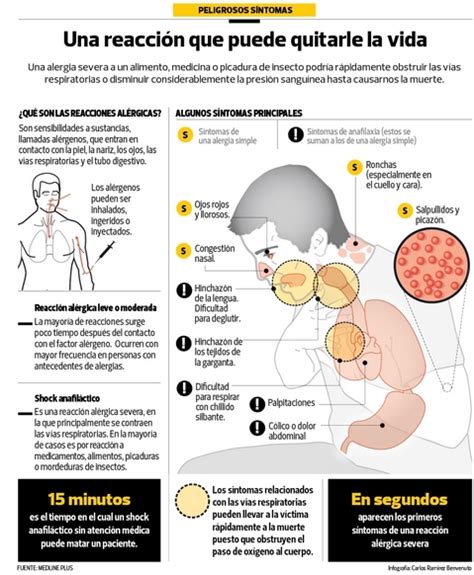 Shock Anafiláctico En Niños ⇒ ¿cómo Hay Que Actuar ️