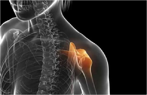 Understanding The Common Shoulder Injuries And Treatment Elivestory