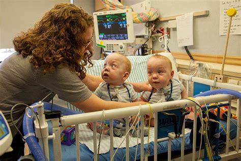 Formerly Conjoined Twins Separated In August To Be Released Nbc News