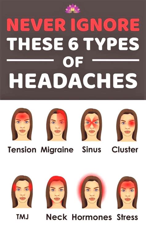 Different Types Of Headaches Meme Captions Lovely