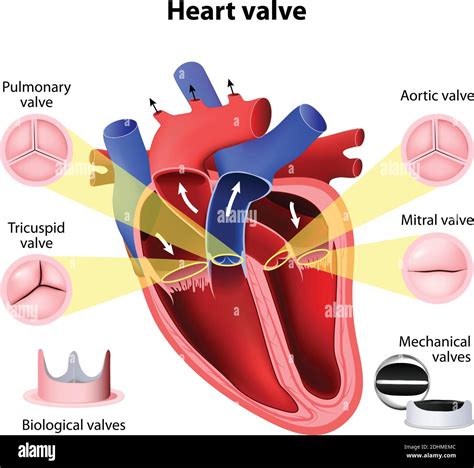 Cirugía Valvular Cardíaca Válvula Pulmonar Tricúspide Aórtica Y