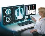 Radiologic Technologist Salary Images