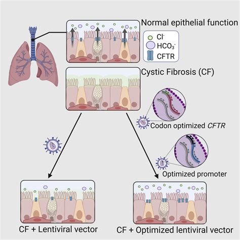 increased cftr expression and function from an optimized lentiviral vector for cystic fibrosis