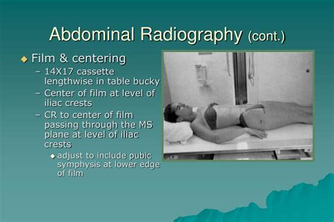 Ppt Introduction To Clinical Radiography Powerpoint Presentation