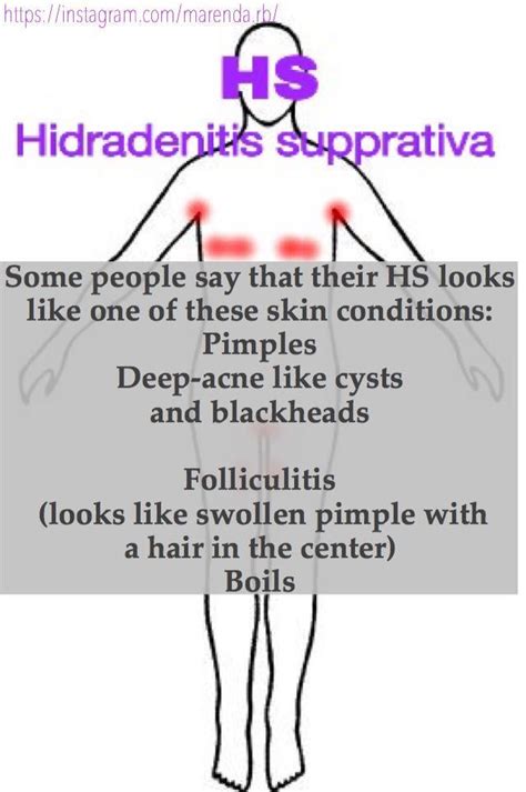 Hidradenitis Hidradenitissuppurativa Acneinversa Skincondition