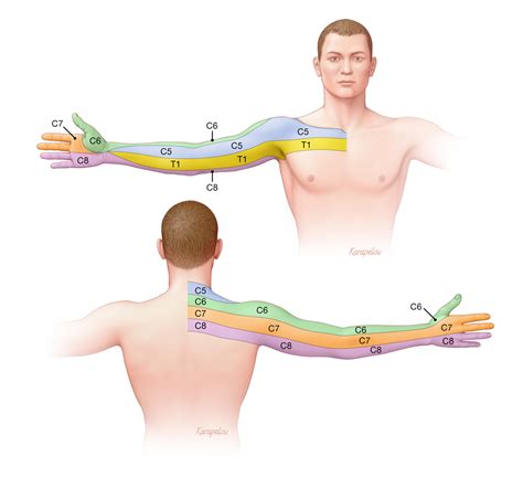 Dermatome Map Upper Extremity Map Of San Francisco Area