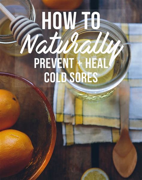 How To Prevent And Treat Cold Sores Naturally Cold Sores Remedies