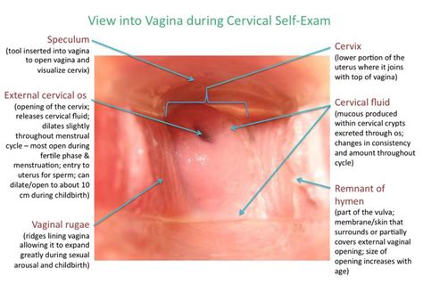 The Beautiful Cervix Project This Website Provides Accessible