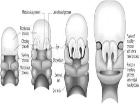 Developmentanatomy And Applied Anatomy Of Maxilla