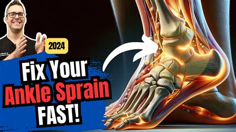 Can You Walk On A Sprained Ankle Rolled Ankle Sprain Recovery Time