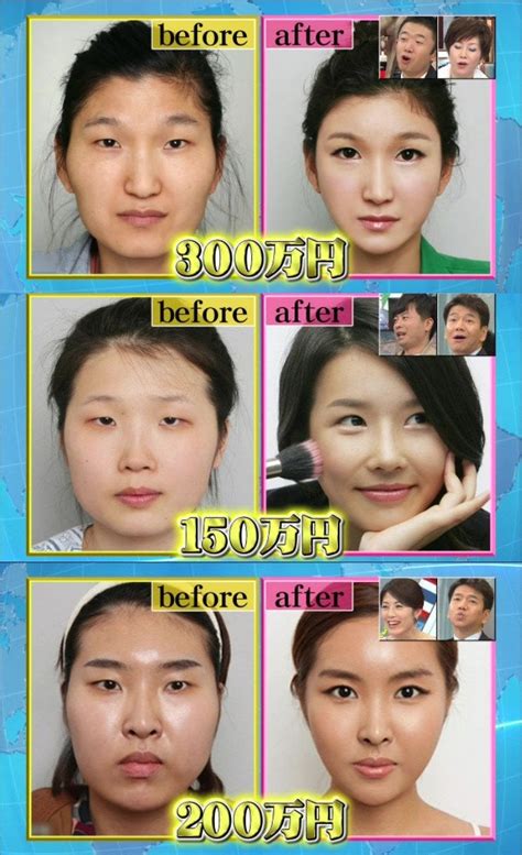 3 Before And Afters South Koreas Plastic Surgery Craze Wtf