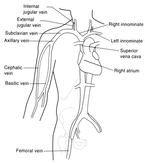 Central Venous Catheter Diagram