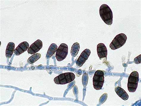 Pseudopithomyces Chartarum Mycology University Of Adelaide