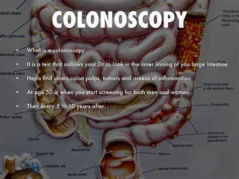 Colonoscopy Age