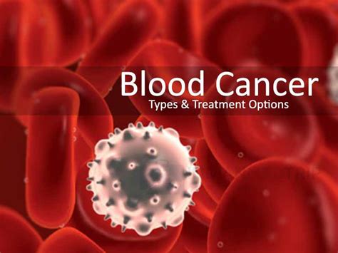 Blood Cancer Types And Treatment Options Healthcare In India
